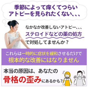 【原因は骨格にあった】アトピー